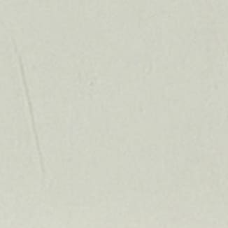 Vitreo 149